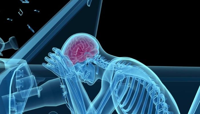 Chấn thương sọ não và nguyên nhân gây chấn thương
